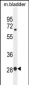 BTF3 Antibody (N-term)